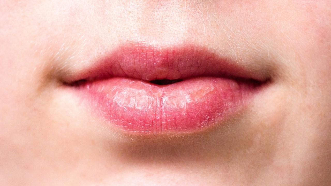 Catat Begini 5 Tips Agar Bibir Tidak Kering Saat Puasa, Lakukan Hal Berikut 