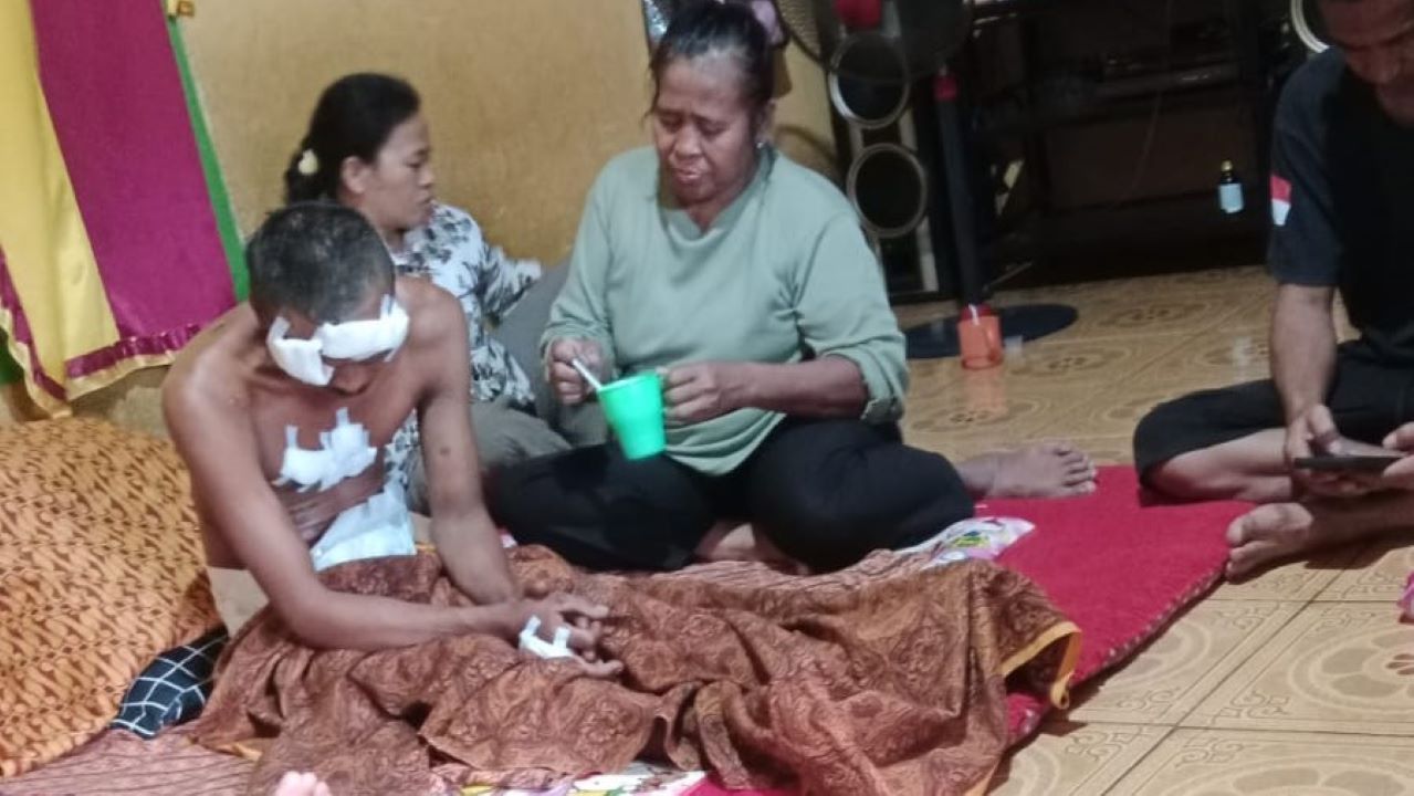 Korban Diserang Beruang di Musi Rawas, Sudah Pulang ke Rumah, Warga Harapkan Pemerintah Turun Tangan