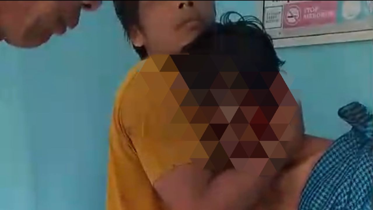 Warga Sukakarya Musi Rawas Diserang Beruang, Luka Parah di Kepala