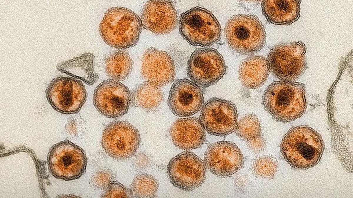 Bisa Sembuh Tanpa Obat, Ilmuwan Berhasil Hilangkan HIV dari Sel Tubuh Pakai Teknologi CRISPR, Benarkah?