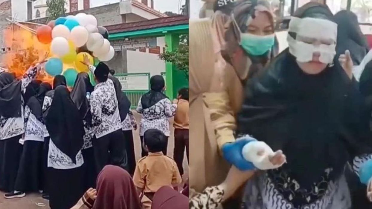 Rayakan Hari Guru Nasional, Balon Gas Meledak, 10 Orang Luka Bakar, Kejadian di Bekasi