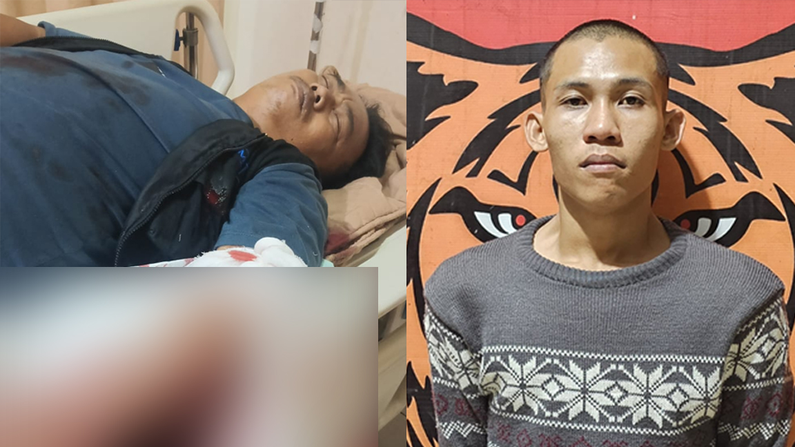 Tebas Tangan Petugas Keamanan Pasar Inpres Lubuk Linggau, Gara-gara Dilarang Masuk