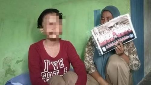 Usai Berobat ke Bidan, Remaja Perempuan di Palembang Tak Bisa Melihat, Mata Nyaris Lepas, Ini Penyebabnya