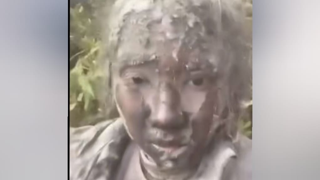 Viral Video Minta Tolong Zhafirah, Korban Pendaki yang Selamat dari Semburan Abu Vulkanik Gunung Marapi Sumbar