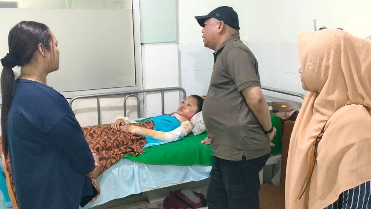 Pengobatan Anak Dibakar Ayah Tidak Bisa Ditanggung BPJS, ini Dasar Hukumnya