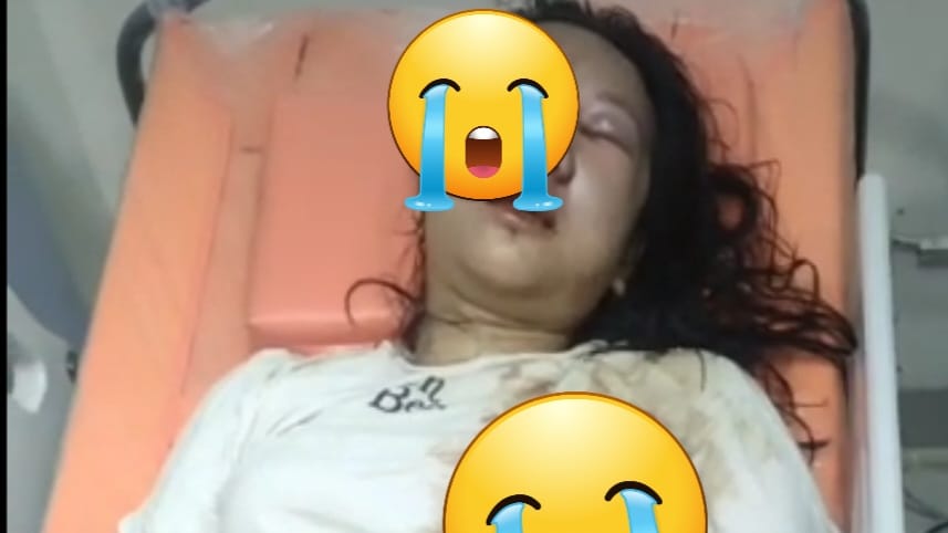Kondisi Terkini Anak Gadis yang Jadi Korban Ayah Kandung di Kuburan Tionghoa Lubuklinggau