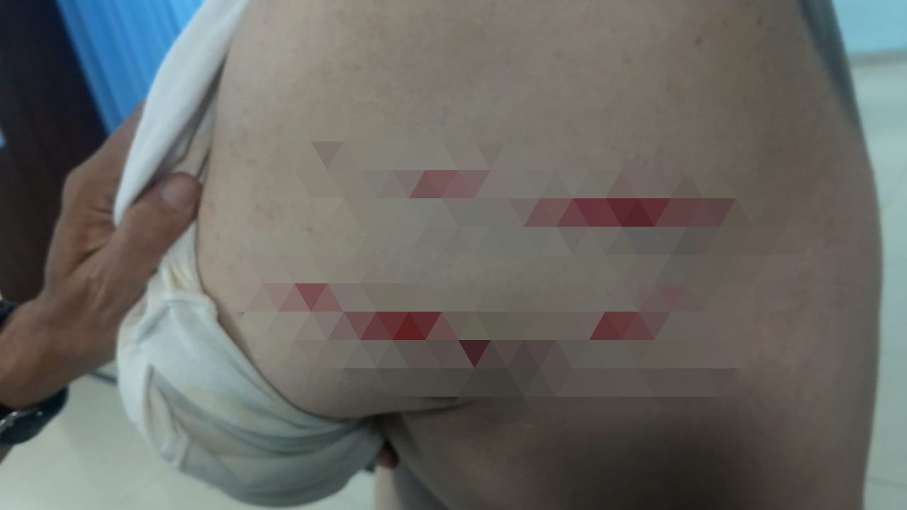 Bos Hotel Arwana Lubuk Linggau Dibacok Preman, Polisi Buru Pelaku