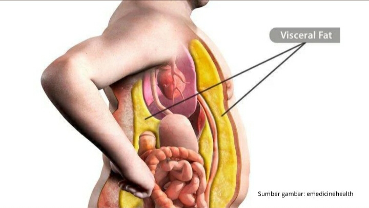 Wahai Pemilik Perut Buncit, 8 Penyakit Perlu Kamu Waspadai!