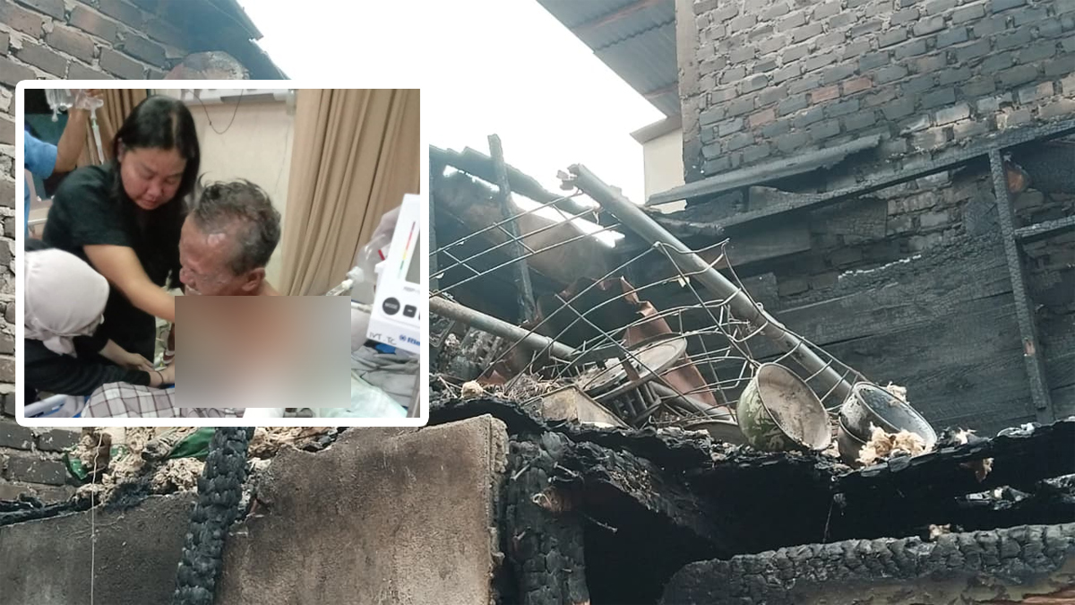 Cerita Lansia di Lubuk Linggau Luka Bakar, Usai Berjibaku Padamkan Api yang Membakar Rumahnya
