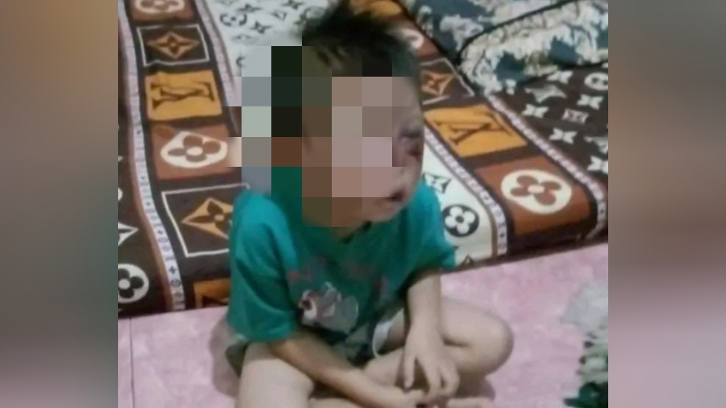 Viral, Beredar Foto Anak Korban Penganiayaan Bapak di Semeteh Musi Rawas, Polisi Turun Tangan