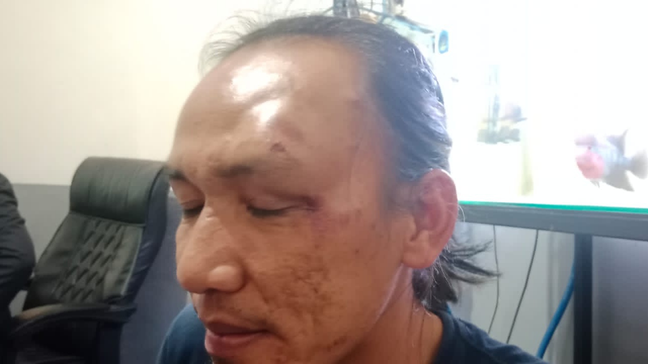 BREAKING NEWS: Wartawan di Lubuklinggau Dipukul Oknum Polisi