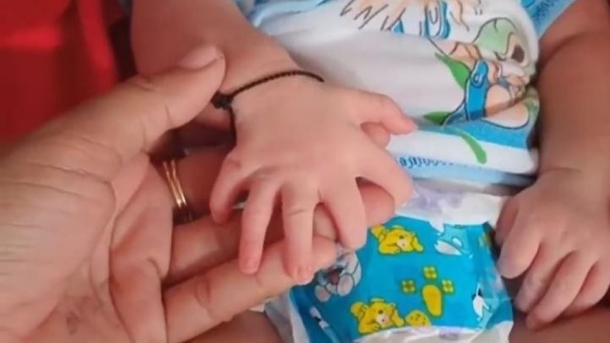 Viral, Bayi Perempuan di Sampang Madura Lahir dengan 24 Jari, Netizen: MasyaAllah