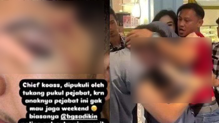 Viral, Dokter Koas FK Unsri Palembang Dipukuli Sopir Ibu Rekannya, Diduga Tak Terima Jadwal Piket Anak