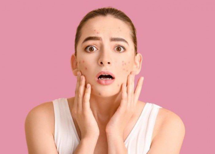 5 Ciri Skincare Tidak Cocok di Kulit, Segeralah Hindari