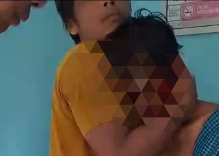Warga Sukakarya Musi Rawas Diserang Beruang, Luka Parah di Kepala