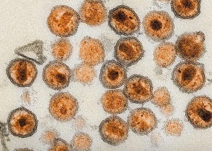Bisa Sembuh Tanpa Obat, Ilmuwan Berhasil Hilangkan HIV dari Sel Tubuh Pakai Teknologi CRISPR, Benarkah?