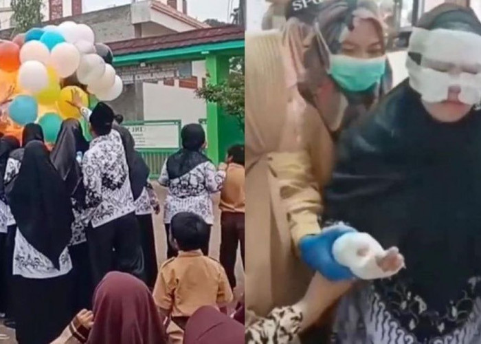 Rayakan Hari Guru Nasional, Balon Gas Meledak, 10 Orang Luka Bakar, Kejadian di Bekasi