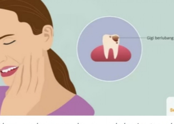 Cara Ampuh Mengobati Gigi Infeksi dan Gusi Bengkak