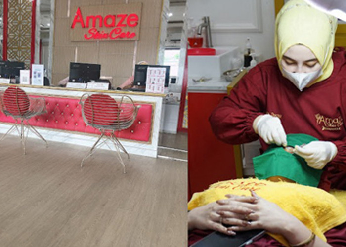 4 Lowongan Kerja di Amaze Skincare Palembang, Cek Posisi dan Kualifikasinya