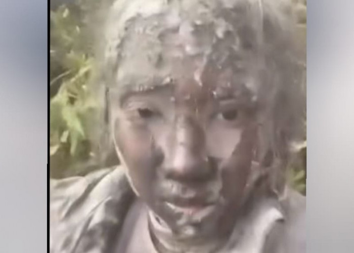 Viral Video Minta Tolong Zhafirah, Korban Pendaki yang Selamat dari Semburan Abu Vulkanik Gunung Marapi Sumbar