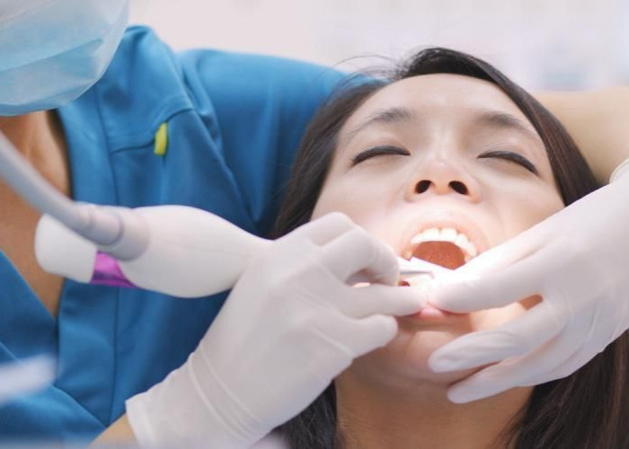 Simak! Begini Cara Membersihkan Karang Gigi Pakai BPJS Kesehatan