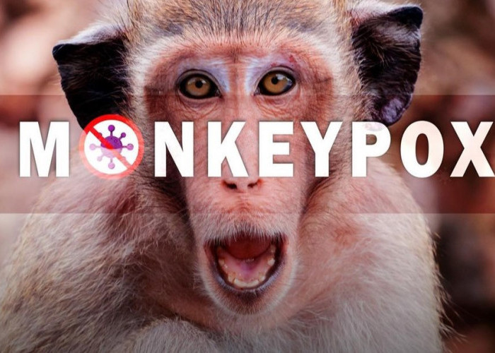 Kasus Cacar Monyet atau Monkeypox Merajalela, ini Informasi Penting yang Wajib Diketahui Tentang Cacar Monyet
