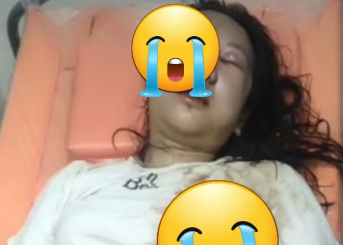Kondisi Terkini Anak Gadis yang Jadi Korban Ayah Kandung di Kuburan Tionghoa Lubuklinggau