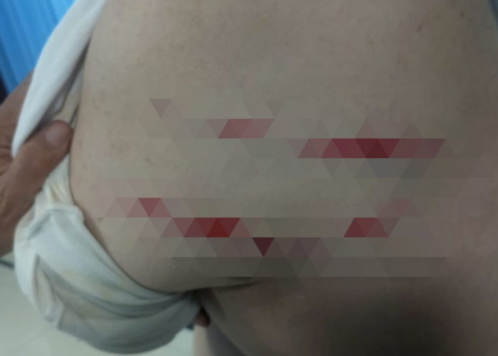 Bos Hotel Arwana Lubuk Linggau Dibacok Preman, Polisi Buru Pelaku