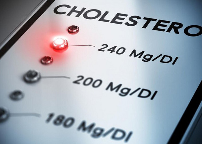 Penderita Kolesterol Tinggi Jangan Khawatir! Catat Inilah 5 Tips Mencegahnya Naik Saat Lebaran