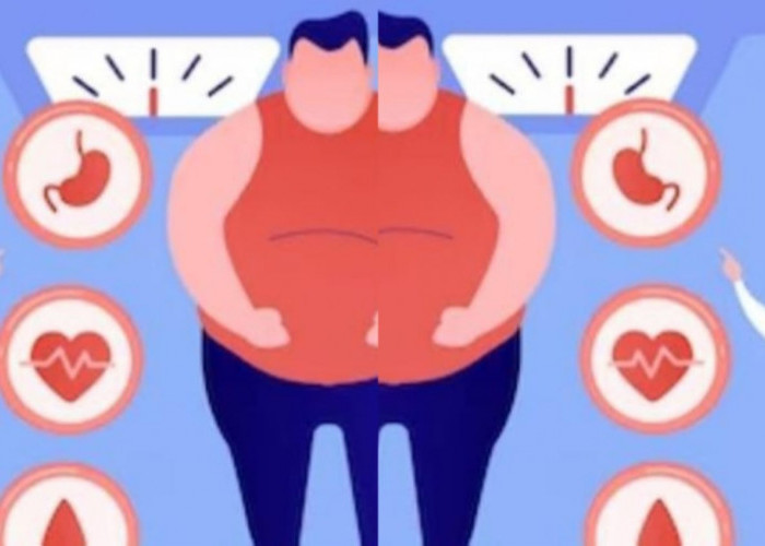 Inilah 14 Dampak Buruk Obesitas Bagi Kesehatan Tubuh