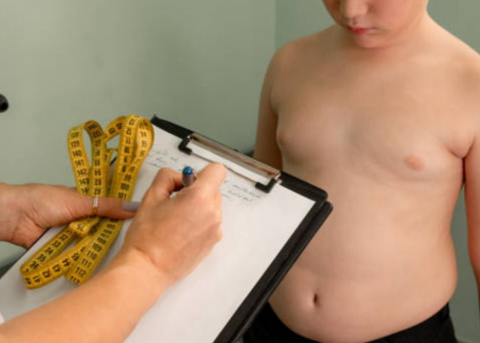 Perlu Orangtua Ketahui, Obesitas pada Anak, Kenali Penyebabnya