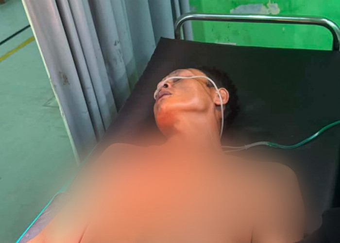 Dituduh Curi Motor, Petugas Jaga Malam di Lubuk Linggau Ditusuk Tetangga Sendiri