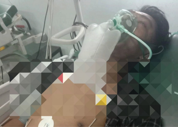 Lagi Ngopi di Teras Warga Semeteh Musi Rawas Meninggal Dunia Dipatuk Ular Cobra