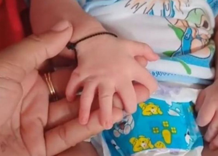 Viral, Bayi Perempuan di Sampang Madura Lahir dengan 24 Jari, Netizen: MasyaAllah