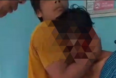 Warga Sukakarya Musi Rawas Diserang Beruang, Luka Parah di Kepala