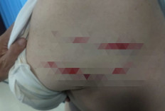 Bos Hotel Arwana Lubuk Linggau Dibacok Preman, Polisi Buru Pelaku